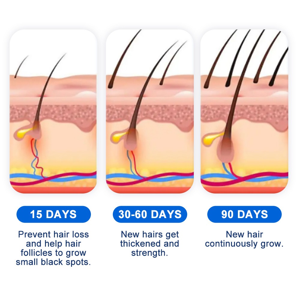 Alopecia Hair Growth Spray Sop - огляд і ціна Hair Care Cream