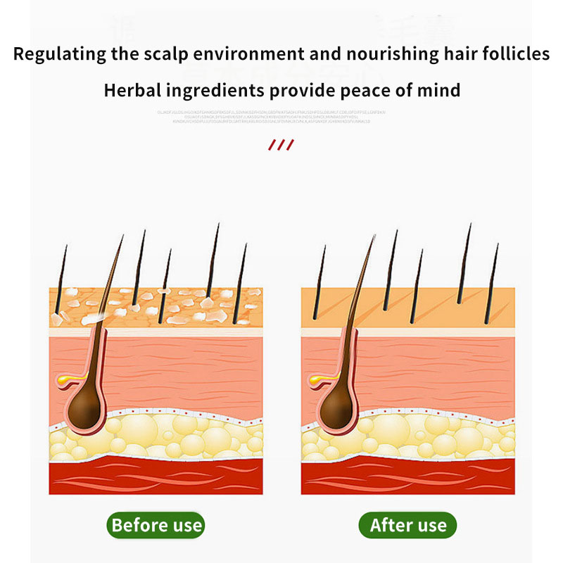 Sophora Flavescens Hair Follic - огляд і ціна Hair Care Cream